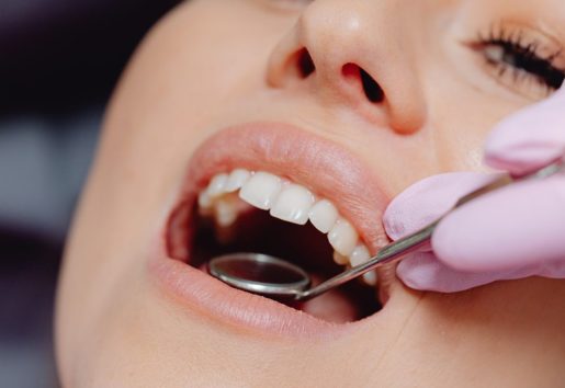 Full Mouth Reconstruction_Clark